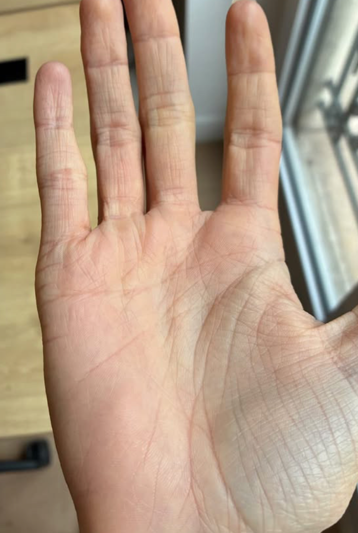 Peau de Léa après Pomad