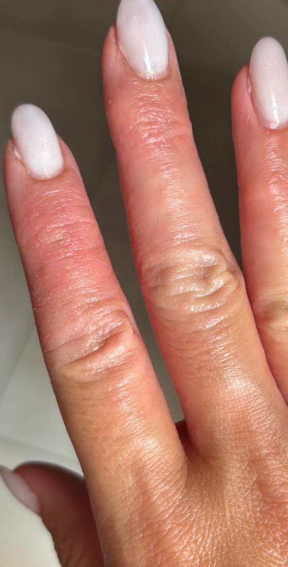 Peau de Justine après Pomad