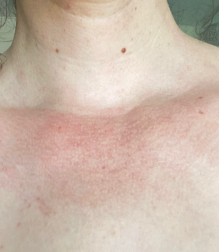 Peau de Lise après Pomad