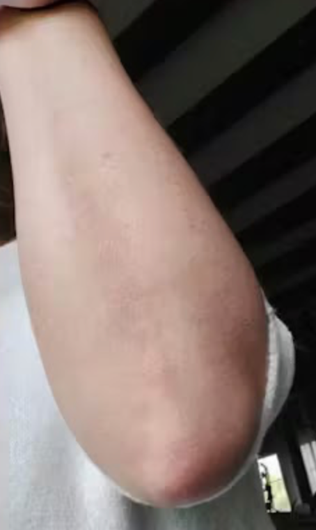 Peau de Carole après Pomad