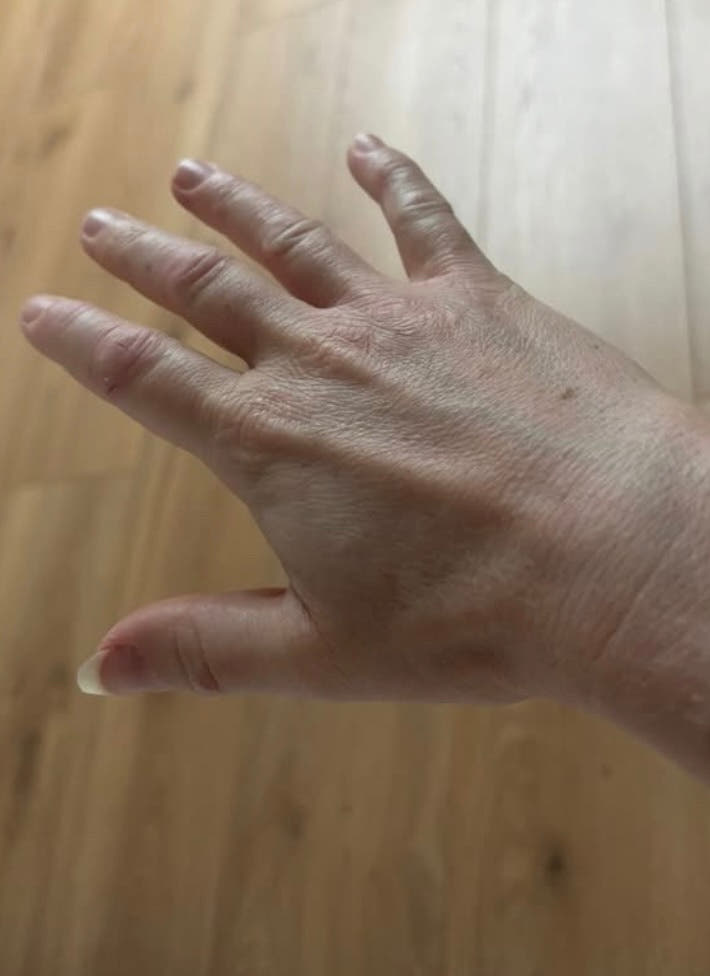 Peau de Juline après Pomad