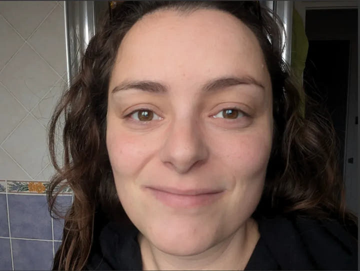 Le même regard, contour des yeux apaisé, après la Cure