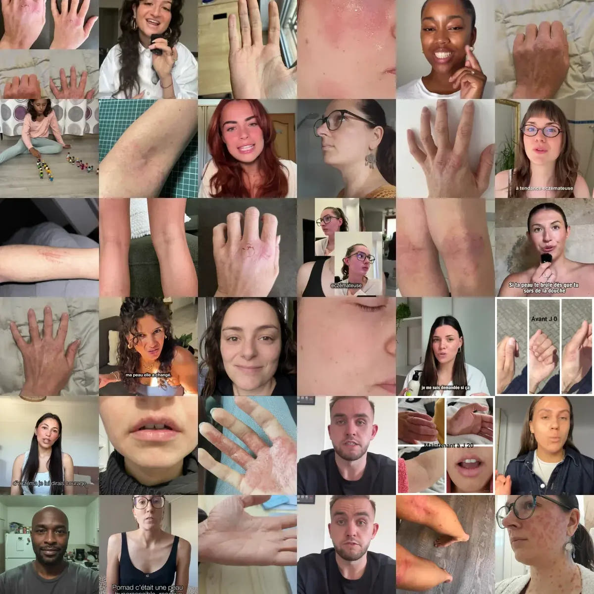 Le mur de la communauté Pomad : avant/après et vidéos transmis par des clientes et des clients, peaux non retouchées